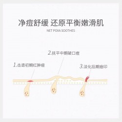 AVIGERS艾薇格诗美颜祛痘净润精华液20ml痘肌去粉刺淡化痘印控油抗痘